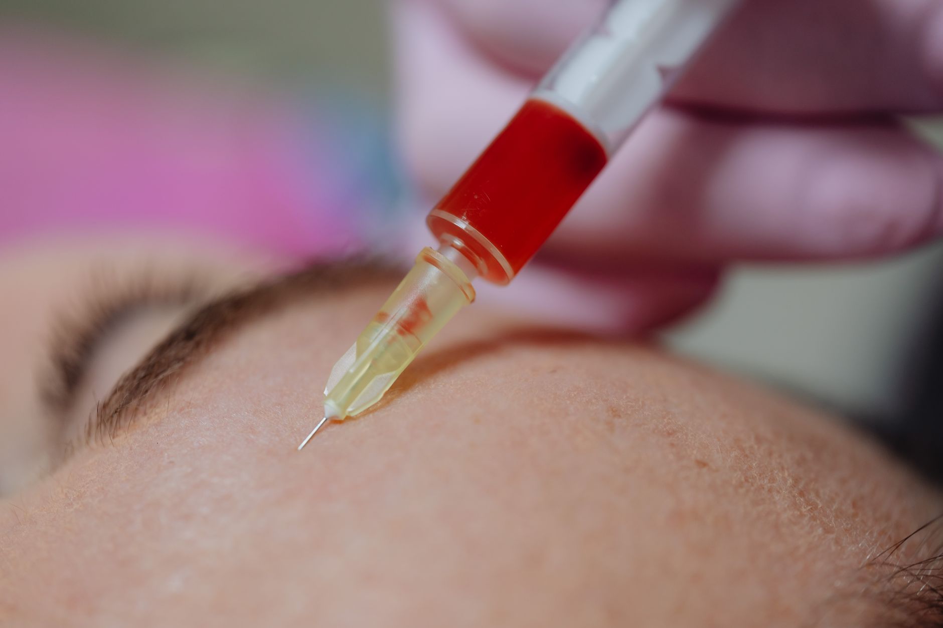 In-office nutrient injection administered during injection therapy in Jacksonville, FL